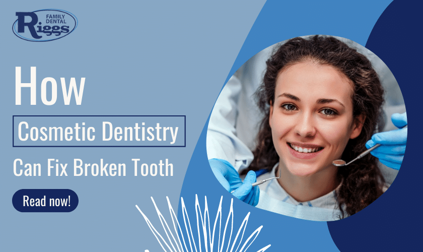 Cosmetic Dentistry for a Broken Tooth